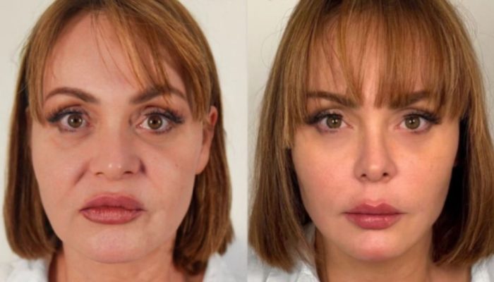 Crédito: jovempan.com.br